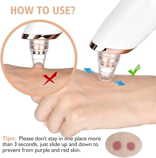 Rechargeable Blackhead Whitehead Remover Device For face Acne Pimple Pore Cleaner Vacuum Suction facial care Tool with adapter For Men & Women